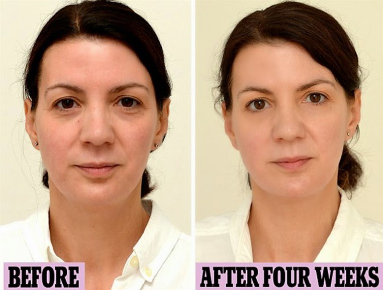 This Woman Drinks Three Litres Of Water Every Day And The Results Are Shocking
